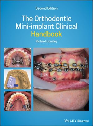 Téléchargez le livre :  The Orthodontic Mini-implant Clinical Handbook