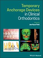 Télécharger le livre :  Temporary Anchorage Devices in Clinical Orthodontics