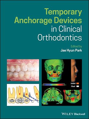 Téléchargez le livre :  Temporary Anchorage Devices in Clinical Orthodontics