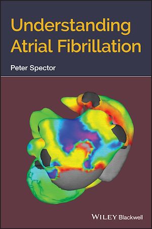Download the eBook: Understanding Atrial Fibrillation