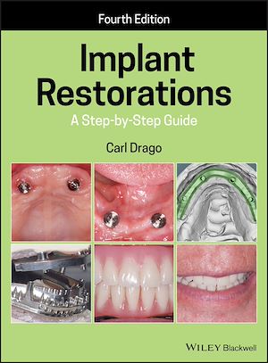Download the eBook: Implant Restorations