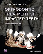 Télécharger le livre :  Orthodontic Treatment of Impacted Teeth