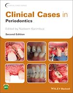 Télécharger le livre :  Clinical Cases in Periodontics