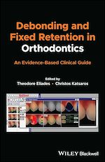 Télécharger le livre :  Debonding and Fixed Retention in Orthodontics