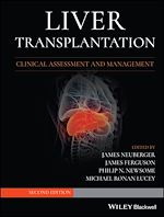 Télécharger le livre :  Liver Transplantation