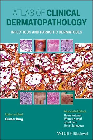 Download the eBook: Atlas of Clinical Dermatopathology
