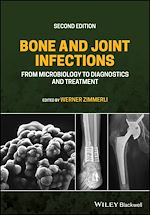 Download this eBook Bone and Joint Infections