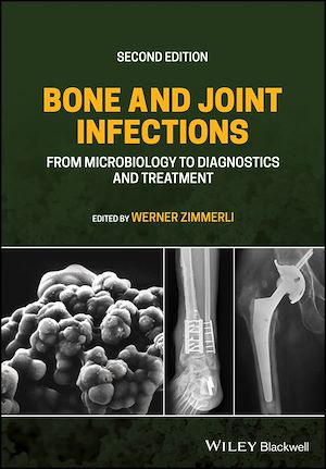 Download the eBook: Bone and Joint Infections