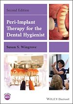 Télécharger le livre :  Peri-Implant Therapy for the Dental Hygienist