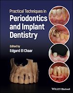 Télécharger le livre :  Practical Techniques in Periodontics and Implant Dentistry
