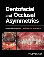 Télécharger le livre :  Dentofacial and Occlusal Asymmetries
