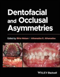 Téléchargez le livre :  Dentofacial and Occlusal Asymmetries