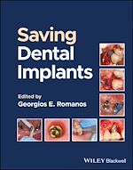 Télécharger le livre :  Saving Dental Implants