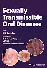 Télécharger le livre :  Sexually Transmissible Oral Diseases