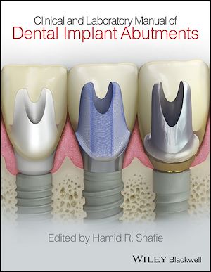 Download the eBook: Clinical and Laboratory Manual of Dental Implant Abutments