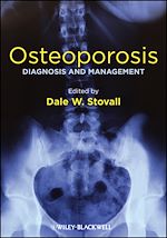 Download this eBook Osteoporosis