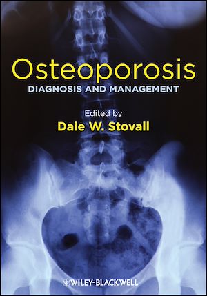 Download the eBook: Osteoporosis