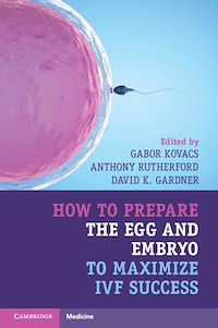 Téléchargez le livre :  How to Prepare the Egg and Embryo to Maximize IVF Success