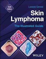 Télécharger le livre :  Skin Lymphoma