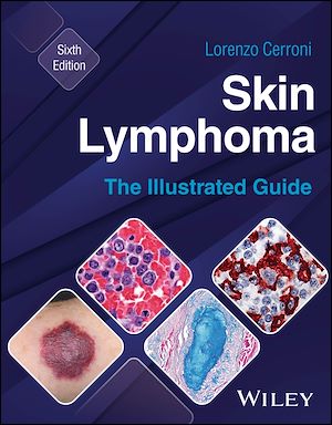 Téléchargez le livre :  Skin Lymphoma
