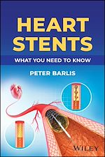 Télécharger le livre :  Heart Stents