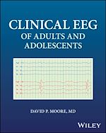 Télécharger le livre :  Clinical EEG of Adults and Adolescents