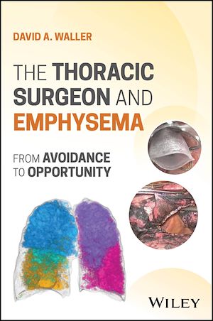 Download the eBook: The Thoracic Surgeon and Emphysema