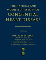 Télécharger le livre :  The Natural and Modified History of Congenital Heart Disease