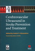 Download this eBook Cerebrovascular Ultrasound in Stroke Prevention and Treatment