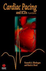 Télécharger le livre :  Cardiac Pacing and ICDs