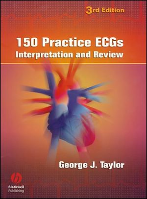 Téléchargez le livre :  150 Practice ECGs