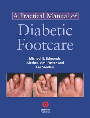 Téléchargez le livre :  A Practical Manual of Diabetic Foot Care