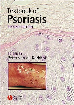 Téléchargez le livre :  Textbook of Psoriasis