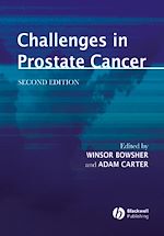 Télécharger le livre :  Challenges in Prostate Cancer
