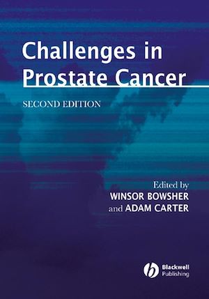 Téléchargez le livre :  Challenges in Prostate Cancer