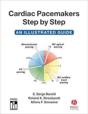 Download the eBook: Cardiac Pacemakers Step by Step
