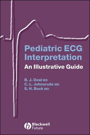 Téléchargez le livre :  Pediatric ECG Interpretation