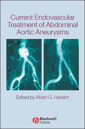 Téléchargez le livre :  Current Endovascular Treatment of Abdominal Aortic Aneurysms