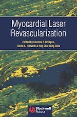Télécharger le livre :  Myocardial Laser Revascularization