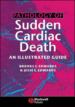 Téléchargez le livre :  Pathology of Sudden Cardiac Death