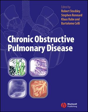 Téléchargez le livre :  Chronic Obstructive Pulmonary Disease