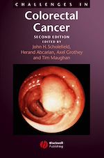 Télécharger le livre :  Challenges in Colorectal Cancer