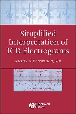 Téléchargez le livre :  Simplified Interpretation of ICD Electrograms
