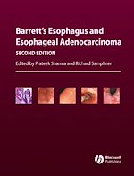Télécharger le livre :  Barrett's Esophagus and Esophageal Adenocarcinoma