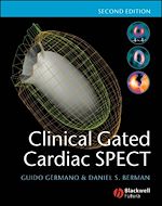 Télécharger le livre :  Clinical Gated Cardiac SPECT