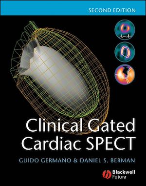 Téléchargez le livre :  Clinical Gated Cardiac SPECT