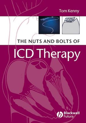 Download the eBook: The Nuts and Bolts of ICD Therapy