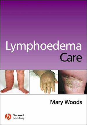 Téléchargez le livre :  Lymphoedema Care