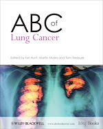 Télécharger le livre :  ABC of Lung Cancer