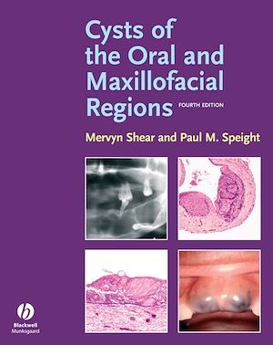 Téléchargez le livre :  Cysts of the Oral and Maxillofacial Regions